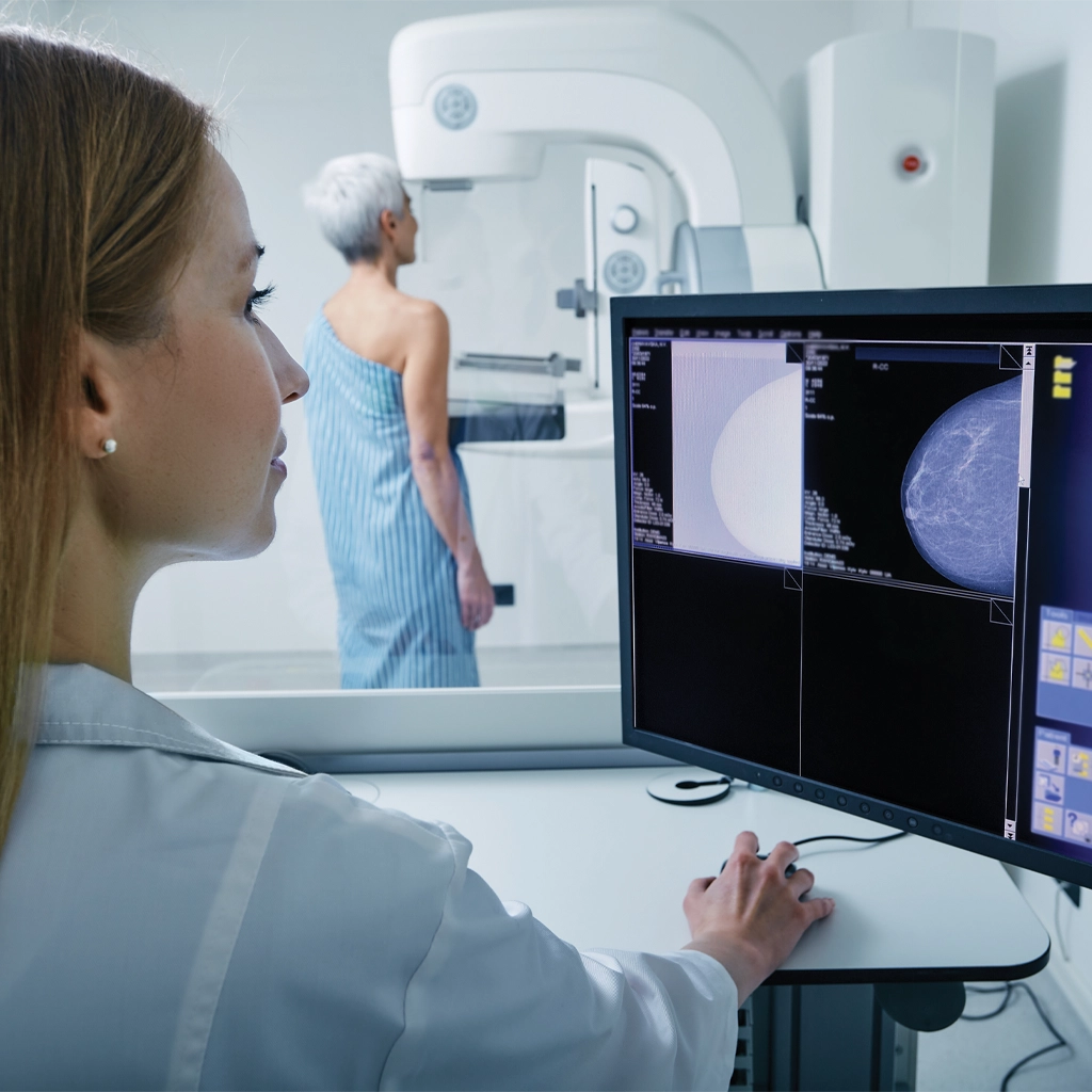 3d mammography